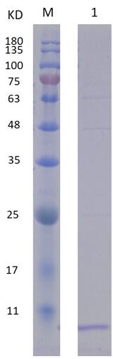 12% SDS-PAGE analysis profiles of purified PA2070-29-80 (CBB stained).